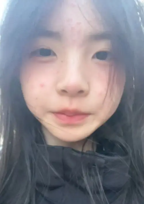 “这种满脸痘的最迷人了”,高中女生素颜走红,让男生3年忘不了