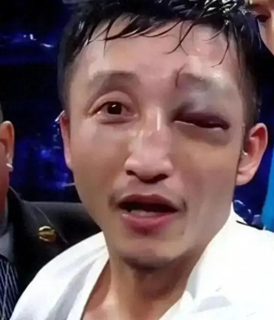 两亿亏损不过是表面现象，冉莹颖再度发声透露实情，揭开了邹市明真实的处境