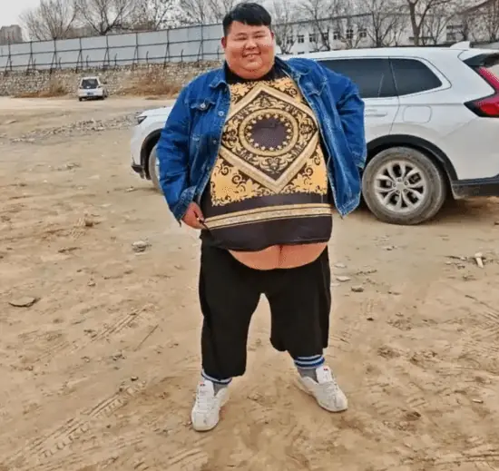 343斤网红良子体检BMI达61.8!网友破防:医生释疑